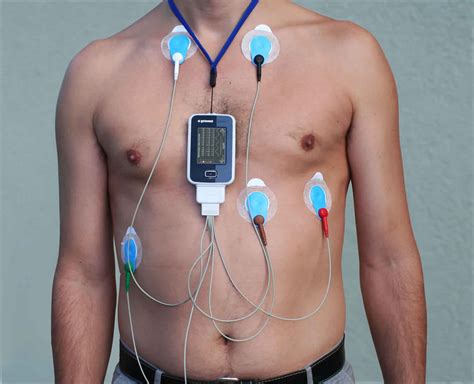 heart test machine|24 hour heart monitor.